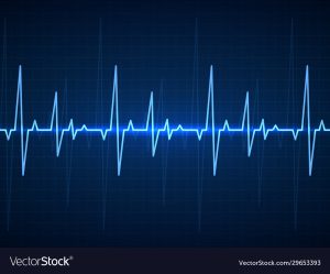 Ekg. Blue sinusoidal pulse lines, monitor with heartbeat signal. Cardiogram pulsing, resuscitation equipment healthcare vector background